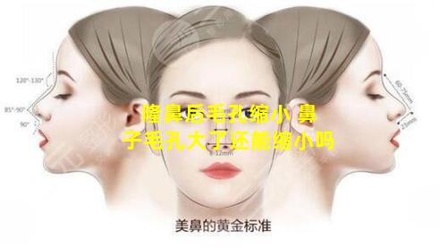 隆鼻后毛孔缩小 鼻子毛孔大了还能缩小吗